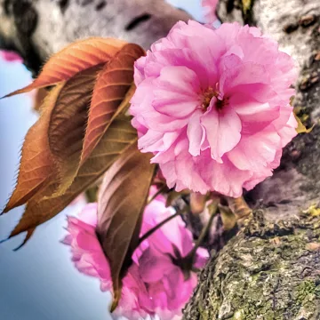 Aşı Yarası